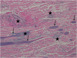 Muscle from the tongue of a yearling black bear with multiple sarcocysts (arrows) within muscle cells associated with marked inflammatory cell infiltrate (stars).