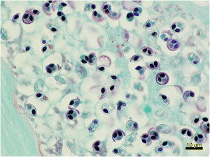 Figure 3: Numerous Myxobolus cerebralis organisms (Arrows). Twort’s Gram's stain. 40X magnification